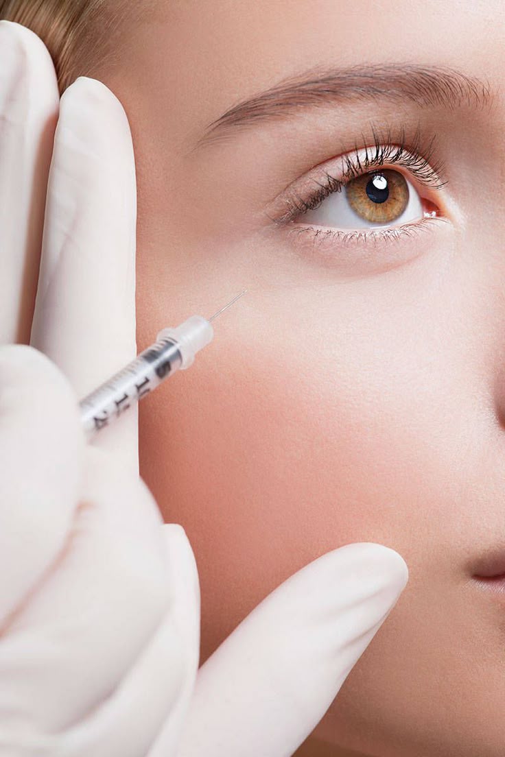 Should You Get Under Eye Fillers This Year?