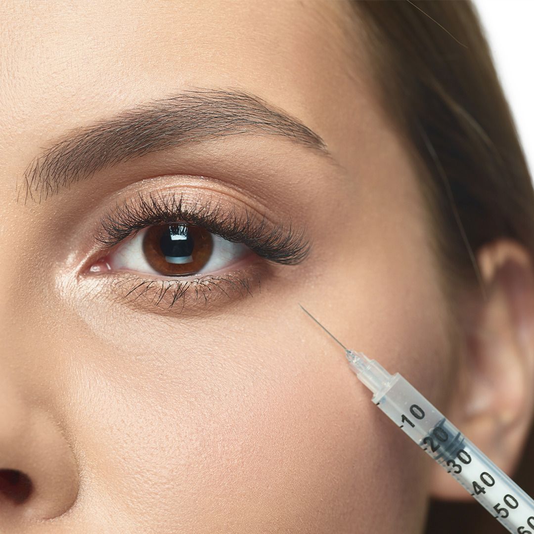 Can Dark Circles Treatment Help With Under-Eye Changes After 40?
