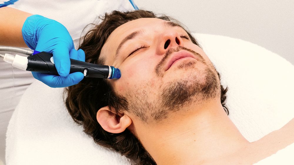 Can Hydrafacial Help Create a Smoother-Looking Pore Appearance?