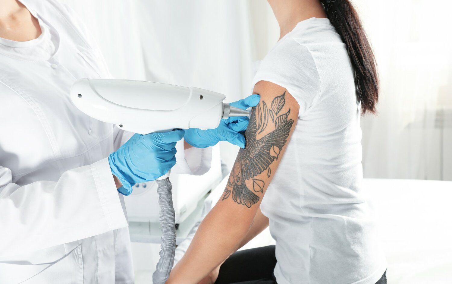 Can Laser Tattoo Removal Help With Tattoos You Got in Your Youth?
