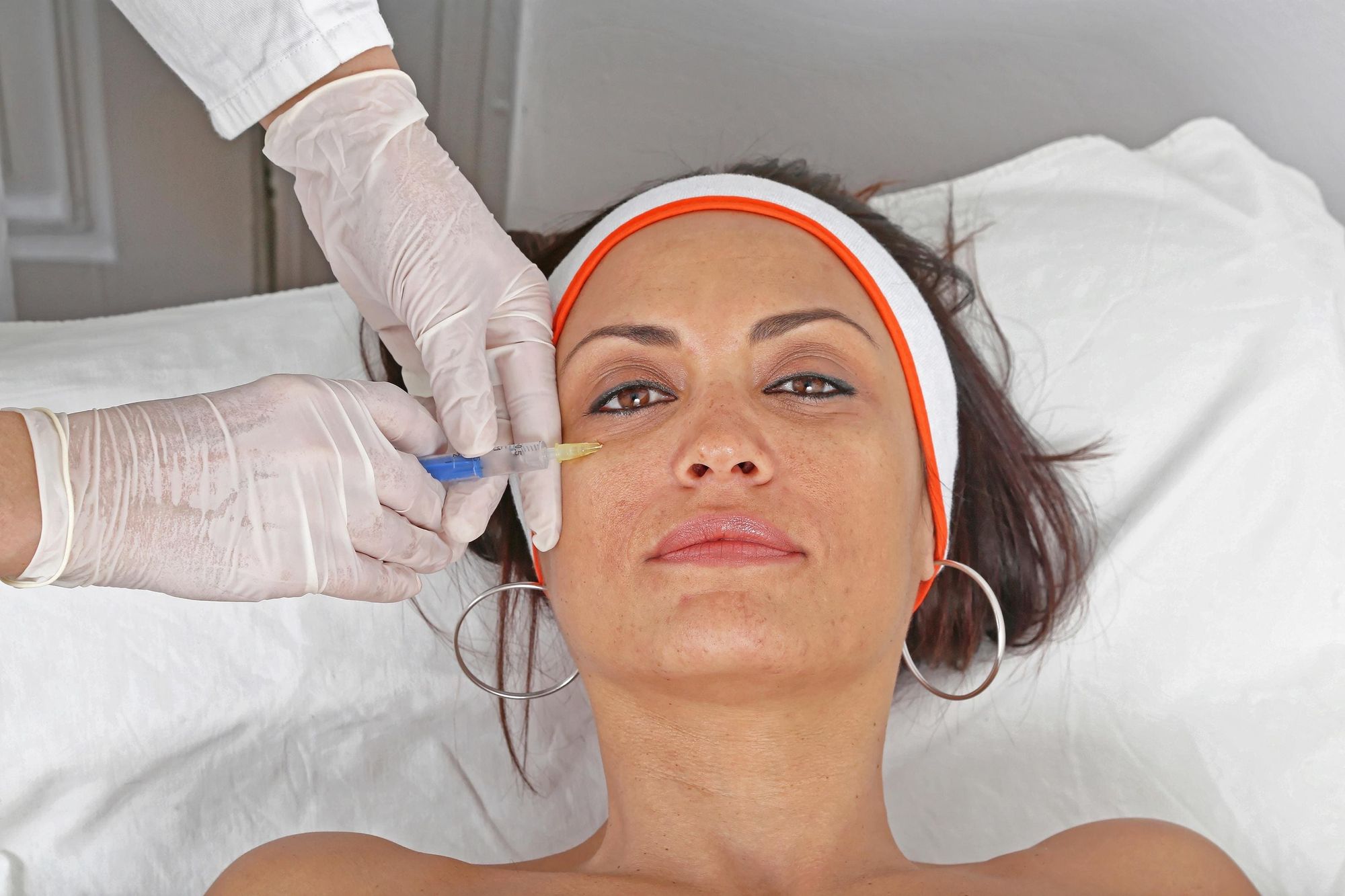 Can Under Eye Fillers Improve the Transition Between the Eye and Cheek?