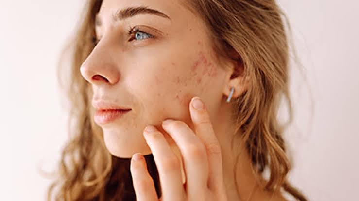 How Are Different Facial Scars Treated?